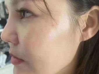 玉面坊专业祛痣1条评价|人均 -祛痘|华联商厦建伟发