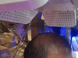 -碧莲盛·不剃发植发