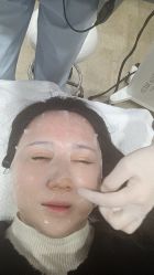 体验后-上海首尔丽格医疗美容医院
