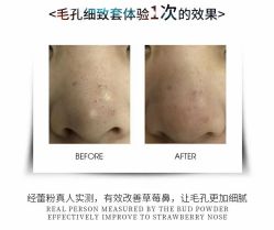 -蕾特恩专业祛痘·皮肤管理