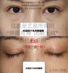 -Yestar宁波艺星整形医院
