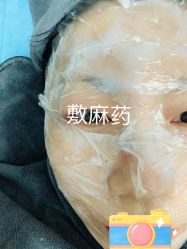 体验前-More摩尔医美の注射线雕光电中心