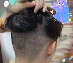 -大麦微针植发全国连锁