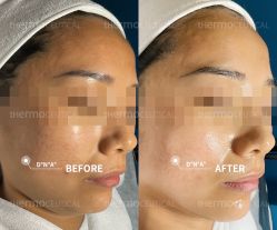 -苗方清颜痘肌研究所