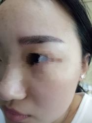 -郡艺医疗美容·微整·眼鼻吸脂