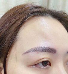 点击看大图 体验后-重庆联合丽格第五医疗美容医院