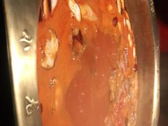 -小龙坎老火锅(华飞店)