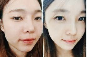 -SKINIST丽铂医疗美容