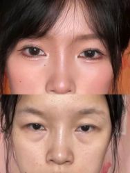 -紫洁俪方（北京）医疗美容