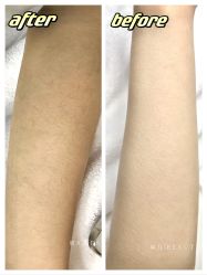 -植蔻妍倍儿专业脱毛·皮肤管理