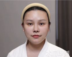 体验后-杭州米兰柏羽医疗美容医院