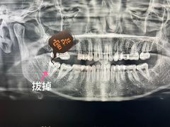 -同步齿科·数字化正畸种植口腔中心(珠海店)