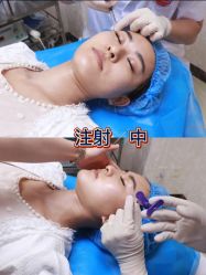 体验后-紫洁俪方（北京）医疗美容