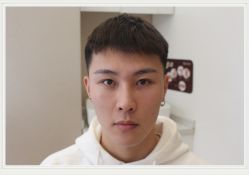 -大麦微针植发全国连锁