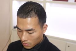 -大麦微针植发丨全国连锁