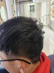 -大麦微针植发丨全国连锁