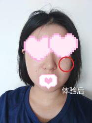 -成都西区医院整形美容