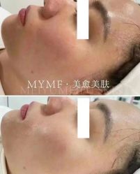 -美愈美肤MEIYU SKIN