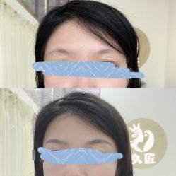 -久匠半永久纹眉