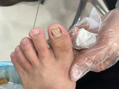 -世龙世家甲沟炎·灰指甲·嵌甲矫正·修脚(武侯区双楠店)