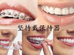 -团圆口腔·种植中心(锦江院区)