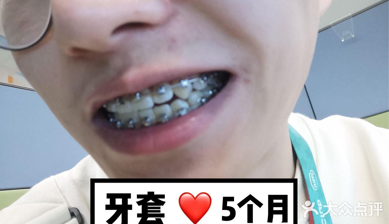 【案例分享】今天我们来讲个小帅哥的正畸案例