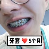【案例分享】今天我们来讲个小帅哥的正畸案例