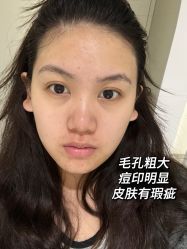 体验前-联合丽格·张菡丽格医疗美容