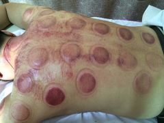 -益友堂盲人推拿正骨穴位按摩工作室