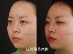 -北京米扬丽格医疗美容·联合丽格鼻整形中心