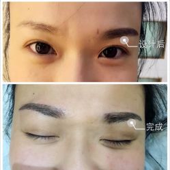 -MUSES专业脱毛比基尼サロン日式连锁