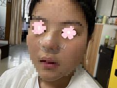 -杭州仁易堂中医康复医院疤痕修复