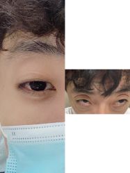 体验后-坤如玛丽·医疗美容中心