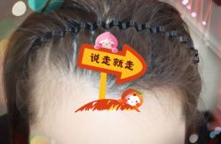 -大麦微针植发全国连锁