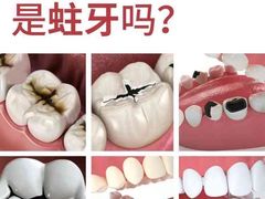 -上海仁爱医院口腔科 · 种植