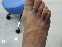 -Andrew指甲专科灰指甲·甲沟炎矫正·3D步态矫形鞋垫定制(浦三路店)