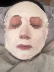 -skin79皮肤管理中心