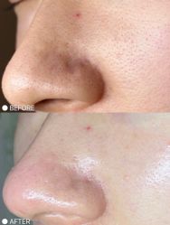 点击看大图 -美肤盾祛痘·问题肌头疗管理中心