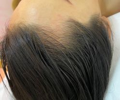 -MISS STAR·半永久纹眉·发际线·美瞳线