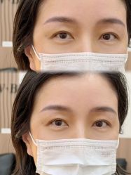 点击看大图 -Verywang半永久纹眉•仪器野生眉
