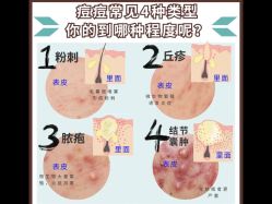 -苗方清颜痘肌研究所