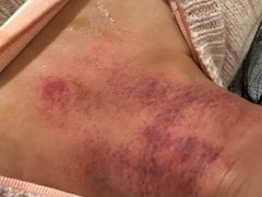 -承启堂中医馆·推拿·针灸(成华馆)