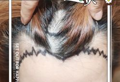 -大麦微针植发全国连锁