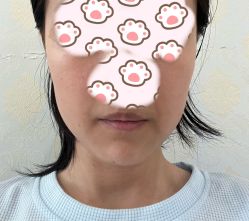 体验后-上海玫瑰医疗美容医院