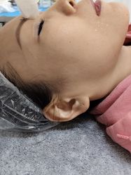 -长沙雅美医疗美容医院