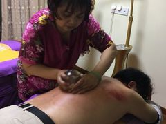走罐-沈师傅盲人按摩工作室(密三小区店)
