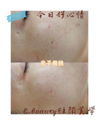 -E.beauty驻颜·痘敏肌调理中心
