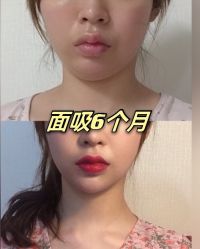 -上海漾颜医疗美容