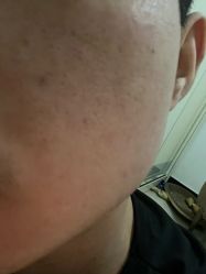 体验后-重庆军科整形美容医院