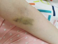 -浙江省立同德医院(翠苑院区)